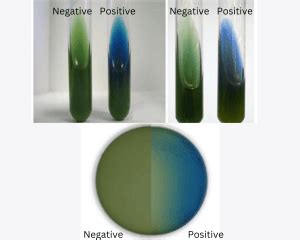 citrate test results|1.20: Citrate Test .